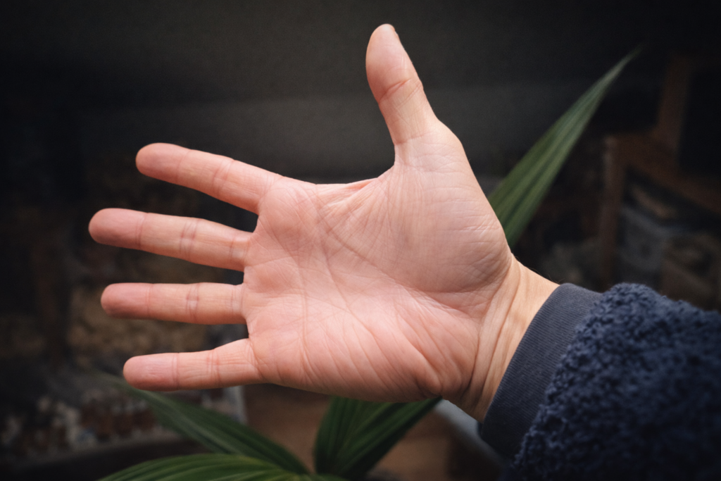 burn-out reconstruction évolution apaisement 6 mois